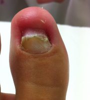 Oongle sans résine.JPG