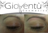 restructuration sourcils.jpg