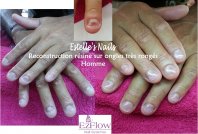 20140418 reconstruction homme.jpg