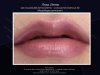full lips.jpg