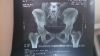 ForumRunner_20140731_124024.png