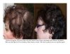 Nutriol hair system 2.jpg