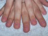 ongles emeline 001.jpg