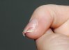 ongle cassé.jpg
