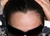 800px-Widows_peak_01.jpg