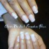 Nailformation